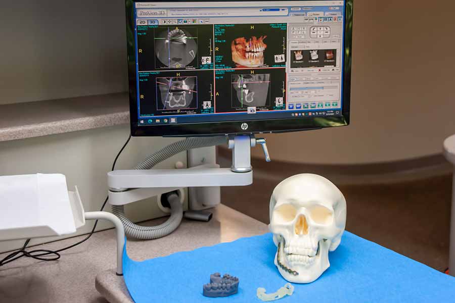 3D-Implant-Treatment-Planning Cosmetic and Restorative Dentistry in Huber Heights, OH ❘ William J. Gioiello D.D.S. Inc.